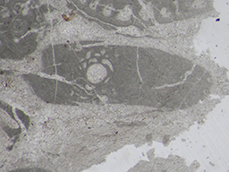 GKD1852_2