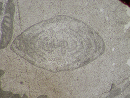 GKD1858_1