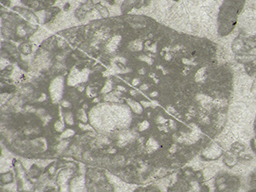 GKD1878_2