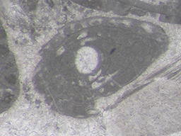 GKD1914_2